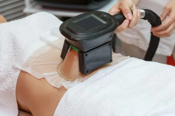 Image of person having fat freezing treatment to help weight gain Hampton in Arden