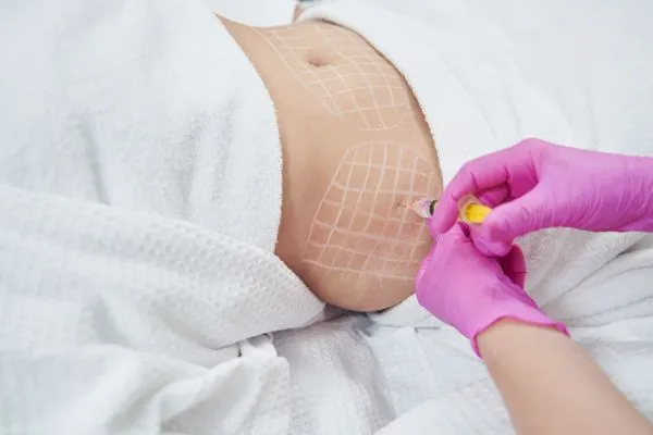 image of fat dissolving injections on love handles to help combat weight gain Hampton in Arden