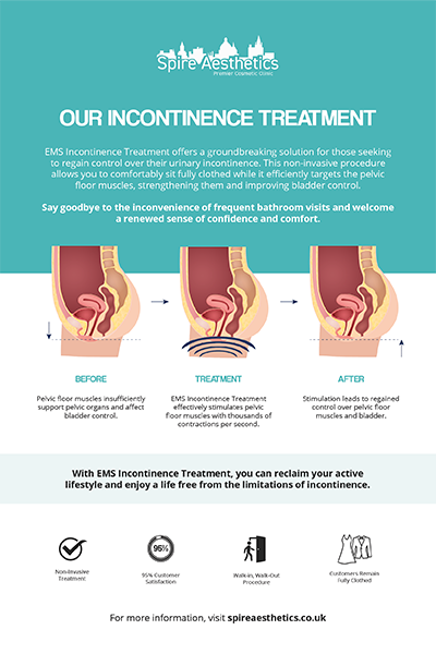 image to show how EMS treatment works for female urinary incontinence Hampton in Arden