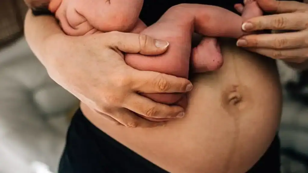 Why Is My Stomach Still Big After Pregnancy Hampton in Arden?